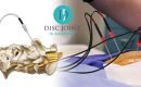 علاج فقرات الظهر