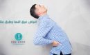 عرق النسا