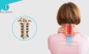 علاج خشونة فقرات الرقبة